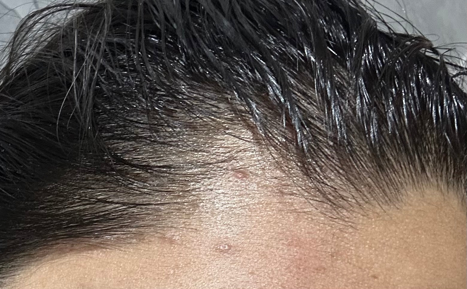 Before
