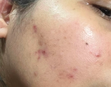 Before skin condition