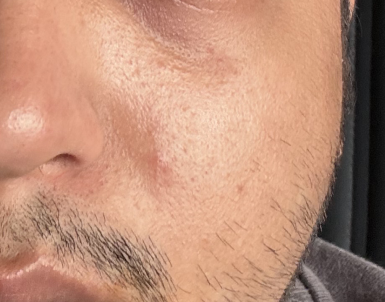 Before skin condition