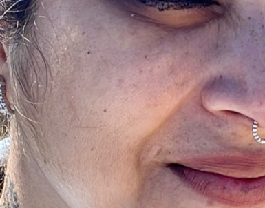 Before skin condition