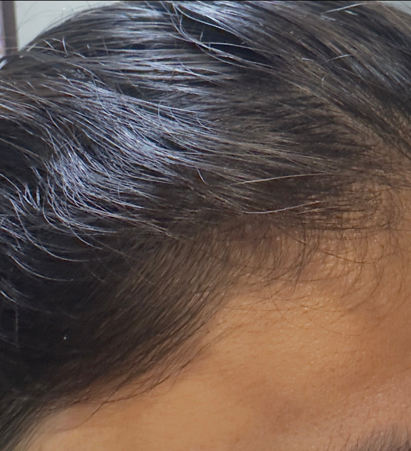After