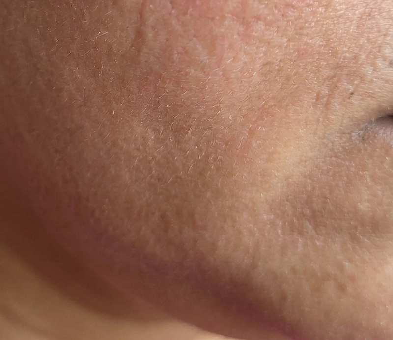 Before skin condition